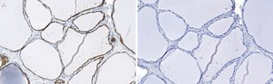 Anti-Bcl-2 Antibody, clone 1K8 ZooMAb® Rabbit Monoclonal recombinant, expressed in HEK 293 cells