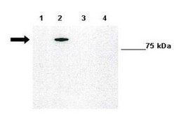 Anti-TP73 antibody produced in rabbit affinity isolated antibody