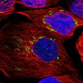 Anti-TXNDC15 antibody produced in rabbit Prestige Antibodies® Powered by Atlas Antibodies, affinity isolated antibody, buffered aqueous glycerol solution