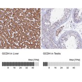 Anti-GCDH antibody produced in rabbit Prestige Antibodies® Powered by Atlas Antibodies, affinity isolated antibody, buffered aqueous glycerol solution