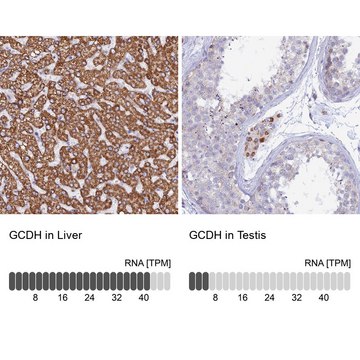 Anti-GCDH antibody produced in rabbit Prestige Antibodies&#174; Powered by Atlas Antibodies, affinity isolated antibody, buffered aqueous glycerol solution