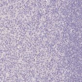 Anti-SLC28A1 antibody produced in rabbit Prestige Antibodies® Powered by Atlas Antibodies, affinity isolated antibody, buffered aqueous glycerol solution