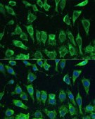 Anti-LGALS3 antibody produced in rabbit