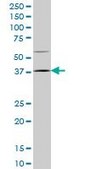 Monoclonal Anti-HOXD9 antibody produced in mouse clone 2A9, purified immunoglobulin, buffered aqueous solution