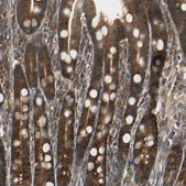 Anti-CCT7 antibody produced in rabbit Prestige Antibodies® Powered by Atlas Antibodies, affinity isolated antibody, buffered aqueous glycerol solution