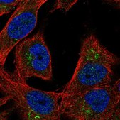 Anti-LGI4 antibody produced in rabbit Prestige Antibodies® Powered by Atlas Antibodies, affinity isolated antibody, buffered aqueous glycerol solution