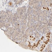 Anti-NKX2-2 antibody produced in rabbit Prestige Antibodies® Powered by Atlas Antibodies, affinity isolated antibody, buffered aqueous glycerol solution