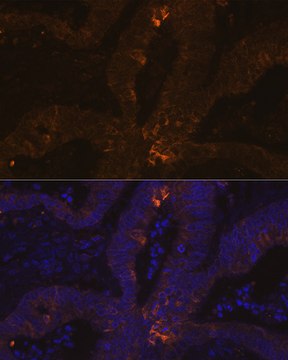 Anti-TFF1/pS2 Antibody, clone 6P6R7, Rabbit Monoclonal