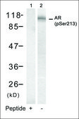 Anti-phospho-AR (pSer213) antibody produced in rabbit affinity isolated antibody