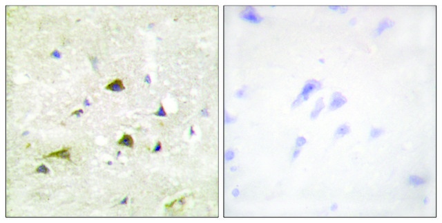 Anti-IKK-&#946; antibody produced in rabbit affinity isolated antibody