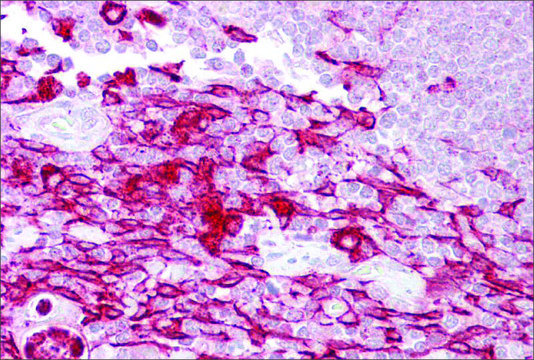 Anti-ATF1 (AB2) antibody produced in rabbit affinity isolated antibody