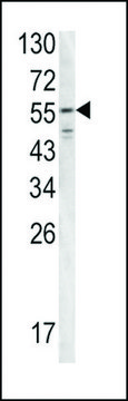 ANTI-FIBB(N-TERMINAL) antibody produced in rabbit purified immunoglobulin, buffered aqueous solution