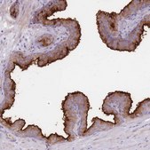 Anti-PLPP1 antibody produced in rabbit Prestige Antibodies® Powered by Atlas Antibodies, affinity isolated antibody, buffered aqueous glycerol solution