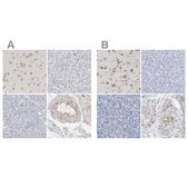 Anti-PNMA1 antibody produced in rabbit Ab1, Prestige Antibodies® Powered by Atlas Antibodies, affinity isolated antibody, buffered aqueous glycerol solution