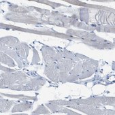 Anti-SLC10A6 antibody produced in rabbit Prestige Antibodies® Powered by Atlas Antibodies, affinity isolated antibody, buffered aqueous glycerol solution