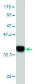 Monoclonal Anti-HOXD11 antibody produced in mouse clone 5E7, purified immunoglobulin, buffered aqueous solution