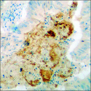 Anti-phospho-PP2A-&#945; (pTyr307) antibody produced in rabbit affinity isolated antibody