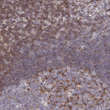 Anti-FOXN3 antibody produced in rabbit Prestige Antibodies&#174; Powered by Atlas Antibodies, affinity isolated antibody, buffered aqueous glycerol solution