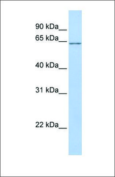 Anti-ANGPTL2 antibody produced in rabbit affinity isolated antibody