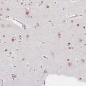 Anti-TCERG1 antibody produced in rabbit Prestige Antibodies® Powered by Atlas Antibodies, affinity isolated antibody, buffered aqueous glycerol solution