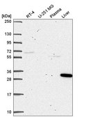 Anti-SQSTM1 antibody produced in rabbit Prestige Antibodies® Powered by Atlas Antibodies, affinity isolated antibody
