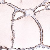 Monoclonal Anti-Nkx2-1 Antibody Produced In Mouse Prestige Antibodies® Powered by Atlas Antibodies, clone CL14528, affinity isolated antibody, buffered aqueous glycerol solution