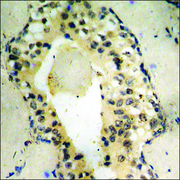 抗-磷酸-SYK (pTyr525) 兔抗 affinity isolated antibody