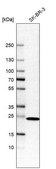 Anti-DHRS2 antibody produced in rabbit Prestige Antibodies® Powered by Atlas Antibodies, affinity isolated antibody