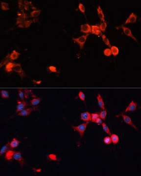 Anti-HSP70 antibody produced in rabbit