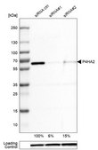 Monoclonal Anti-P4HA2 antibody produced in mouse clone CL0351, Prestige Antibodies® Powered by Atlas Antibodies, purified immunoglobulin, buffered aqueous glycerol solution