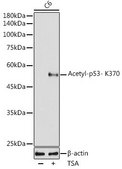 Anti-Acetyl-p53- K370 antibody produced in rabbit