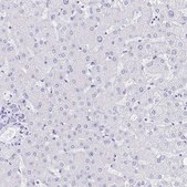 Anti-MEP1B antibody produced in rabbit Prestige Antibodies® Powered by Atlas Antibodies, affinity isolated antibody, buffered aqueous glycerol solution
