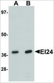 Anti-EI24 antibody produced in rabbit affinity isolated antibody