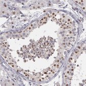 Anti-PRICKLE1 antibody produced in rabbit Prestige Antibodies® Powered by Atlas Antibodies, affinity isolated antibody, buffered aqueous glycerol solution