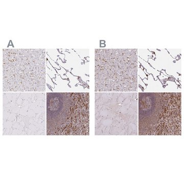 Anti-PYCARD antibody produced in rabbit Prestige Antibodies&#174; Powered by Atlas Antibodies, affinity isolated antibody, buffered aqueous glycerol solution