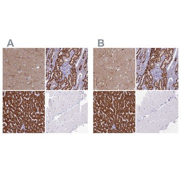 Anti-ABAT antibody produced in rabbit Prestige Antibodies&#174; Powered by Atlas Antibodies, affinity isolated antibody, buffered aqueous glycerol solution