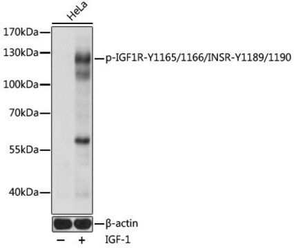 Anti-Phospho-IGF1R-Y1165/1166/INSR-Y1189/1190 antibody produced in rabbit