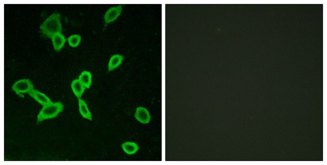 Anti-LGR6 antibody produced in rabbit affinity isolated antibody