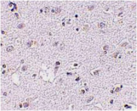 Anti-LASS5 Antibody from rabbit, purified by affinity chromatography