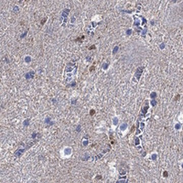 Anti-CAMKK2 antibody produced in rabbit Prestige Antibodies&#174; Powered by Atlas Antibodies, affinity isolated antibody, buffered aqueous glycerol solution