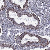 Anti-OSBPL5 antibody produced in rabbit Prestige Antibodies® Powered by Atlas Antibodies, affinity isolated antibody, buffered aqueous glycerol solution