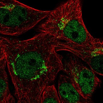 Anti-CYP2U1 antibody produced in rabbit Prestige Antibodies&#174; Powered by Atlas Antibodies, affinity isolated antibody