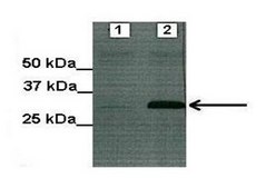 Anti-SIRT5 (AB2) antibody produced in rabbit IgG fraction of antiserum