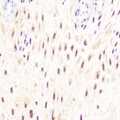 Anti-DP1/TFDP1 antibody produced in rabbit