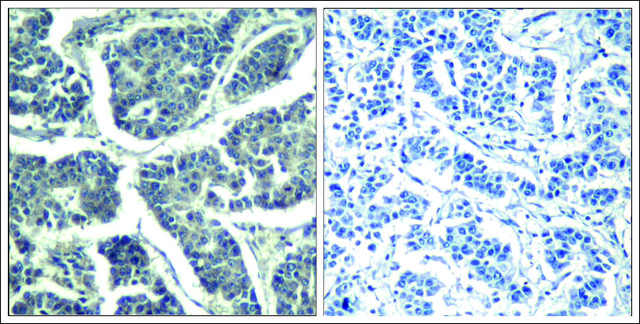 Anti-phospho-PLCG2 (pTyr1217) antibody produced in rabbit affinity isolated antibody