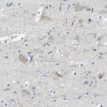 Anti-SORCS1 antibody produced in rabbit Prestige Antibodies&#174; Powered by Atlas Antibodies, affinity isolated antibody, buffered aqueous glycerol solution