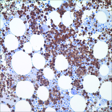 Hemoglobin A (EPR3608) Rabbit Monoclonal Primary Antibody