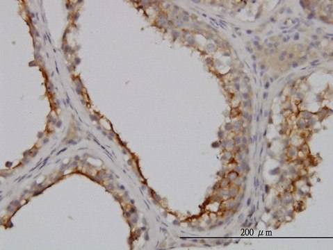 Monoclonal Anti-GGT1 antibody produced in mouse clone 1F9, purified immunoglobulin, buffered aqueous solution