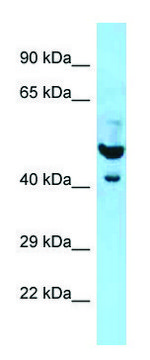 Anti-PLAUR (N-terminal) antibody produced in rabbit affinity isolated antibody