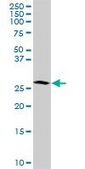 Monoclonal Anti-MAGEA12 antibody produced in mouse clone 3A10, purified immunoglobulin, buffered aqueous solution